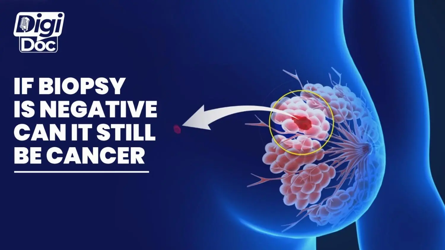 if-biopsy-is-negative-can-it-still-be-cancer