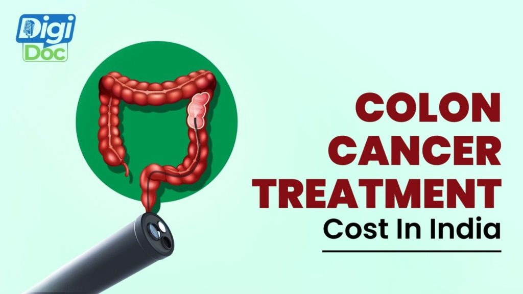colon-cancer-treatment-cost-in-india