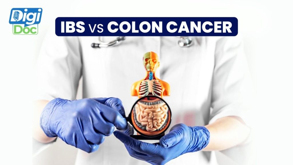 IBS vs Colon Cancer: Key Differences in Symptoms, Causes, Diagnosis & Treatment